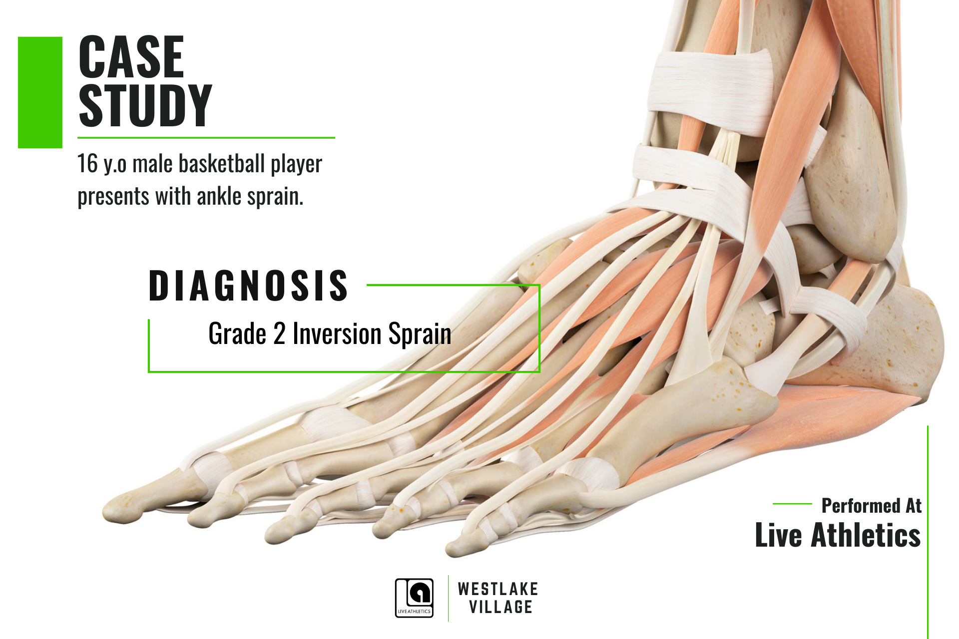 Case Study Ankle Sprain Physical Therapy At Live Athletics • Live